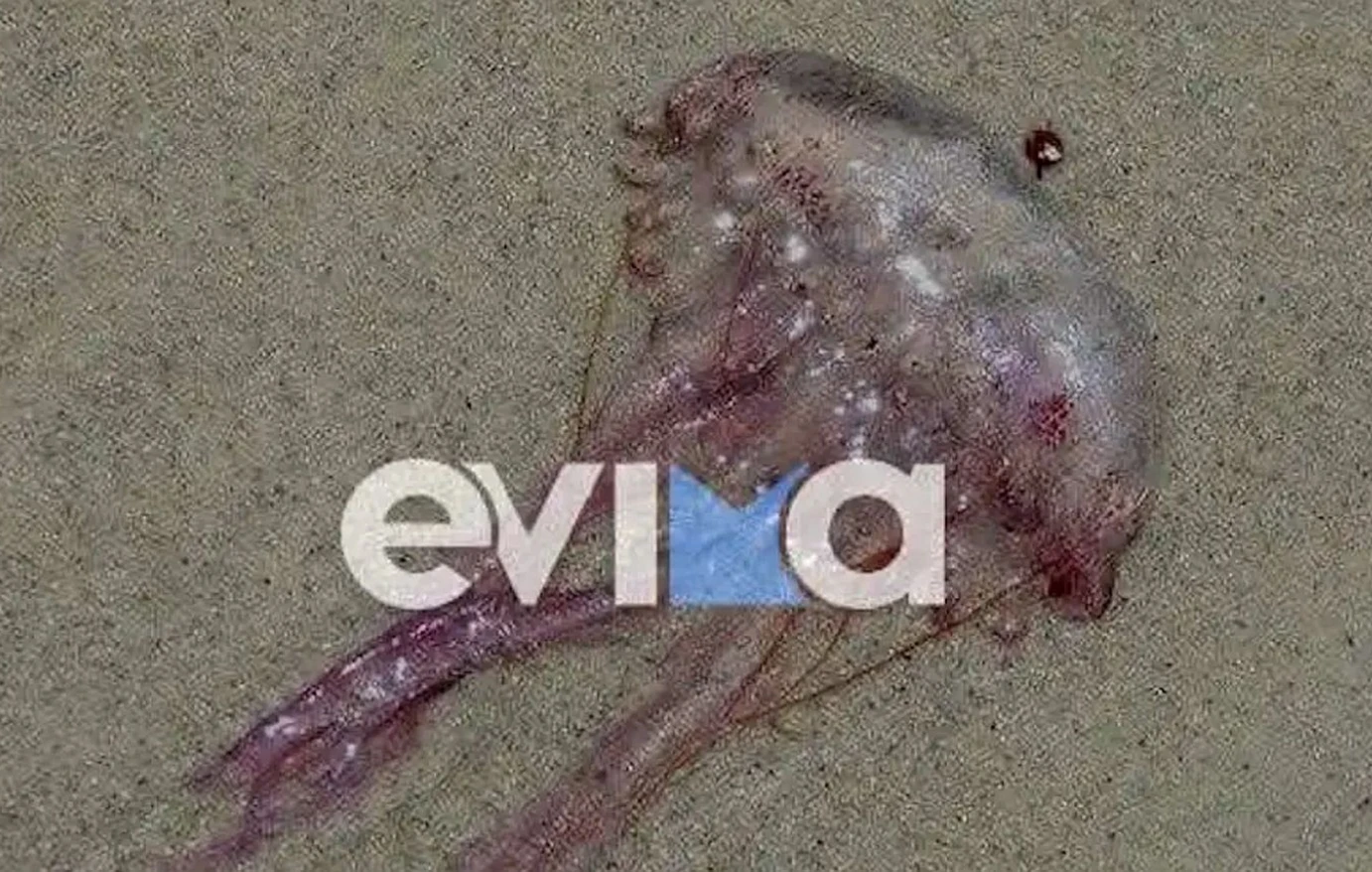 Συναγερμός για τις μωβ μέδουσες - Τι ΔΕΝ πρέπει να κάνετε αν σας τσιμπήσουν